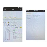CN020219 Aftermarket Smart Keyless Go Remote Key 434MHz 8A Chip 95440-C1500 FCC CQOFD00120 For Hyundai Sonata 2015-2019