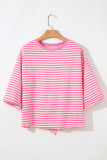 Pink Stripe Bowknot Cutout Back Drop Shoulder Wide Bracelet Sleeve Loose Tee